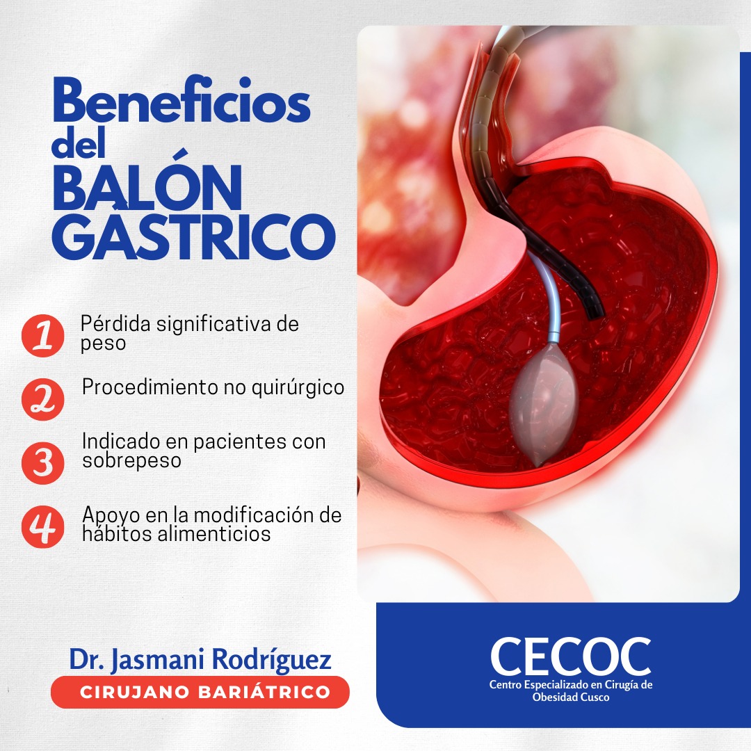 Estos son algunos de los beneficios del Balón Gástrico. Confía en ...
