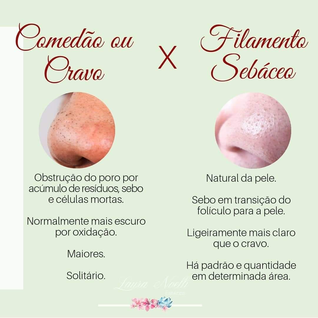 Você sabe a diferença entre cravo... - Laura Noelli Estética | Facebook
