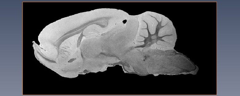FSU / NHMFL - Ultra High Field MRI Microscopy & Spectroscopy ...