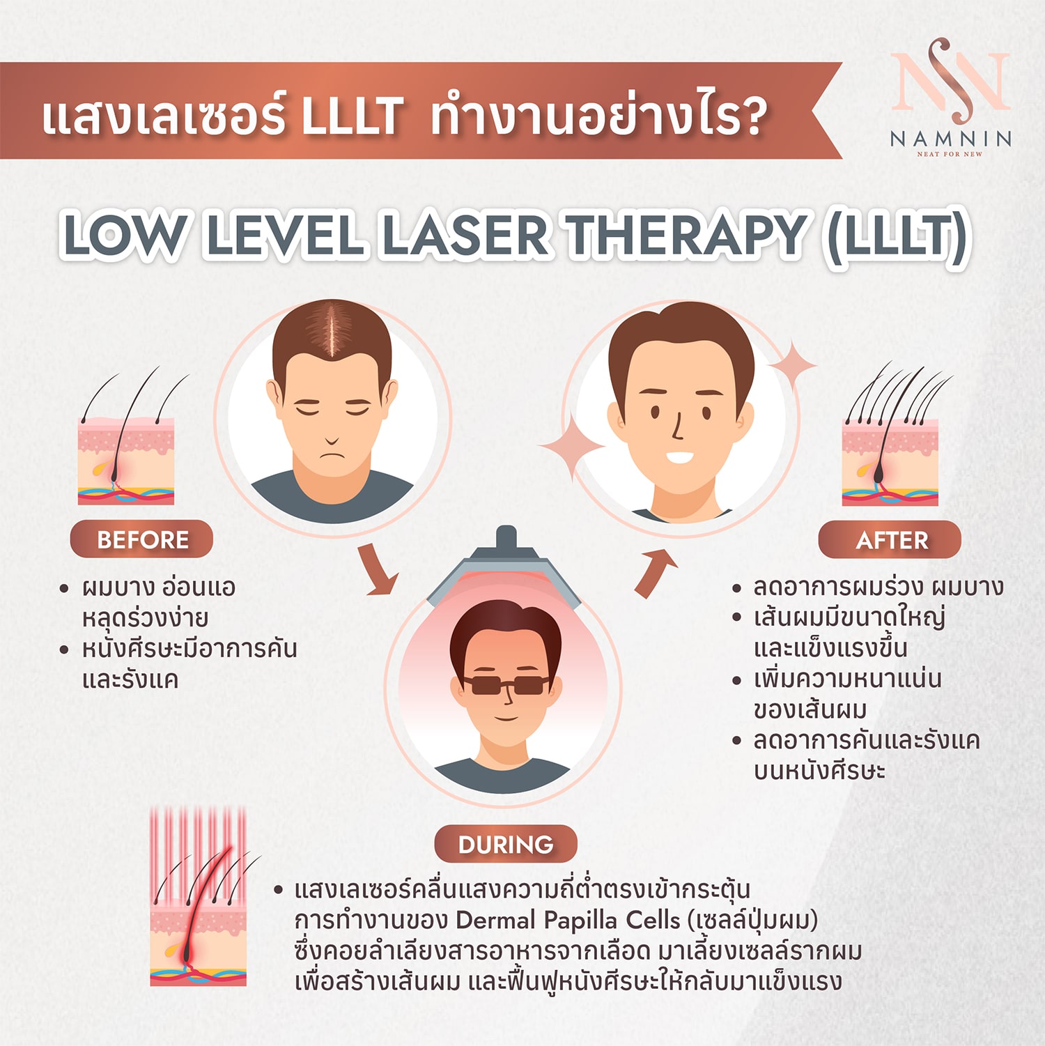 Namnin ForV clinic ปลูกผมถาวรเทคนิค NEAT โดยแพทย์ทุกกราฟ | Facebook