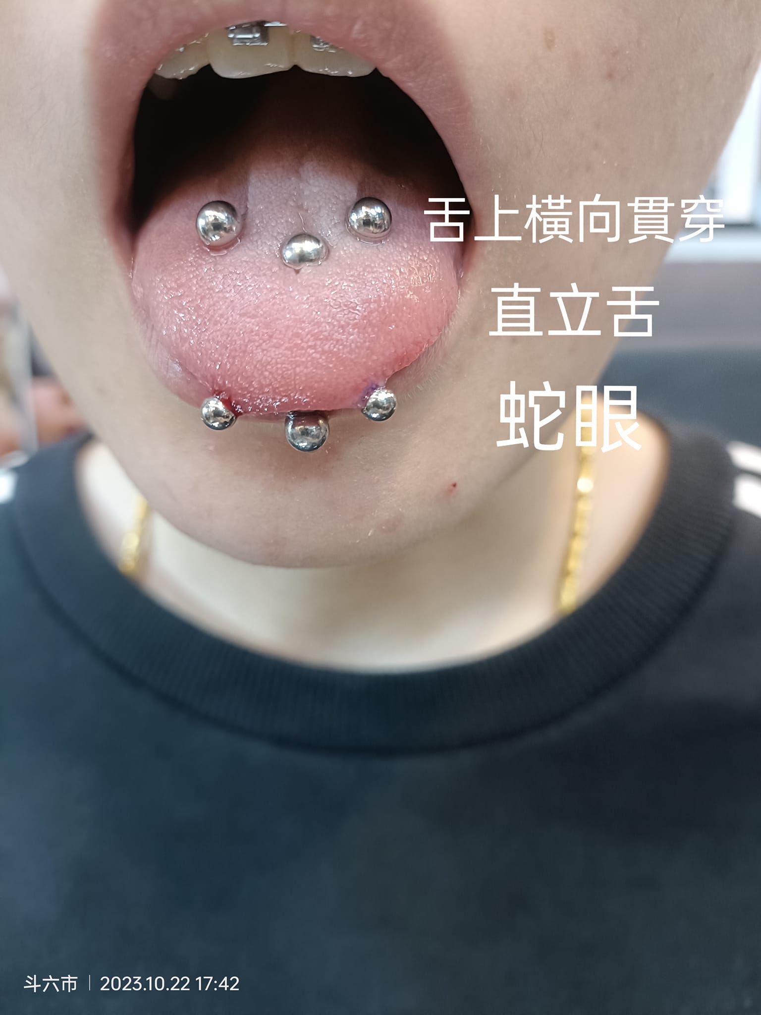 依23飾-專業穿洞 - #斗六人体穿刺 #手穿特殊環 🌟 舌環 🌟 3 種環都有了 #手穿標準環... | Facebook