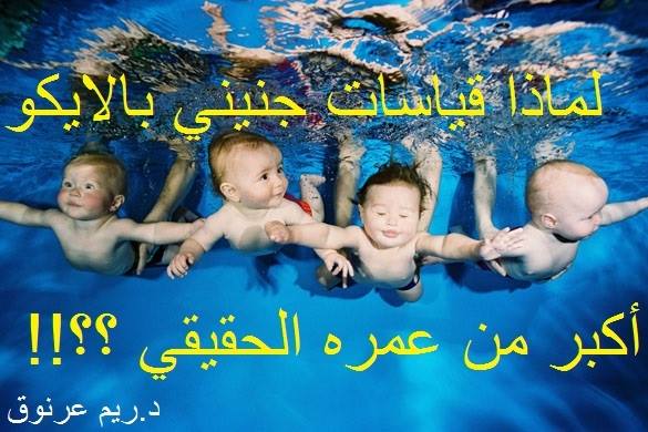 دكتورتي ريم عرنوق هذا صحيح تماما فقياسات جنينك بالايكوغرافي خاصة في أشهر الحمل الأخيرة وبالتحديد قياسات رأس الجنين تبدو أكبر بأسبوع أو أسبوعين أو حتى أكثر من حساباتك
