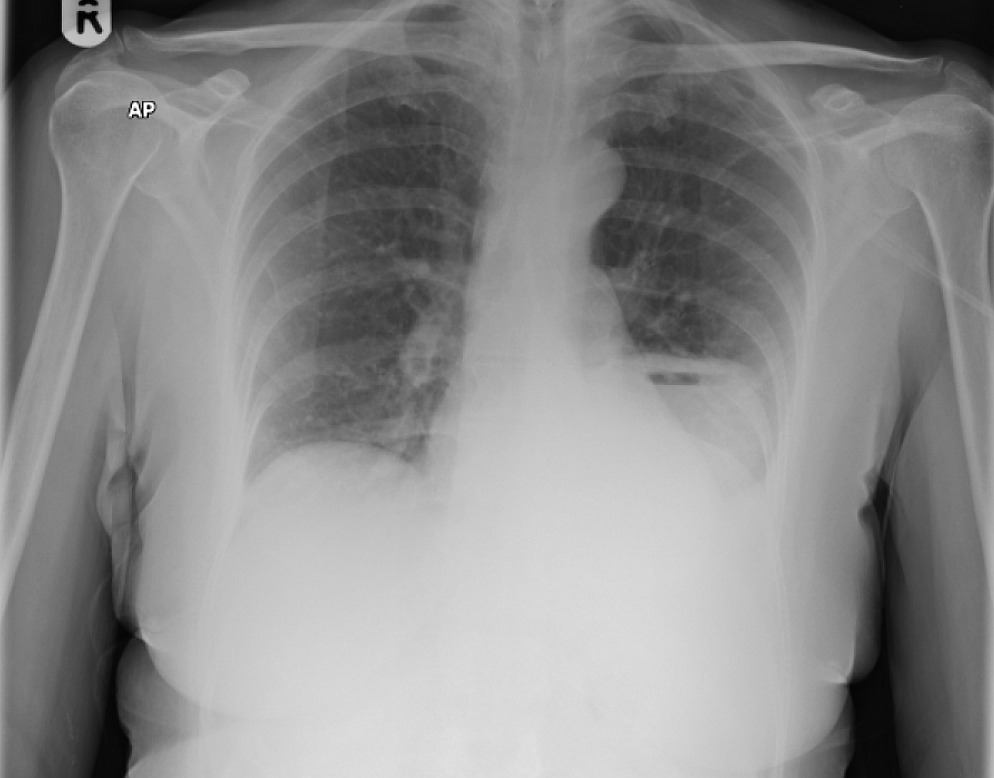 👉 ANSWER:... - Manual of Medicine