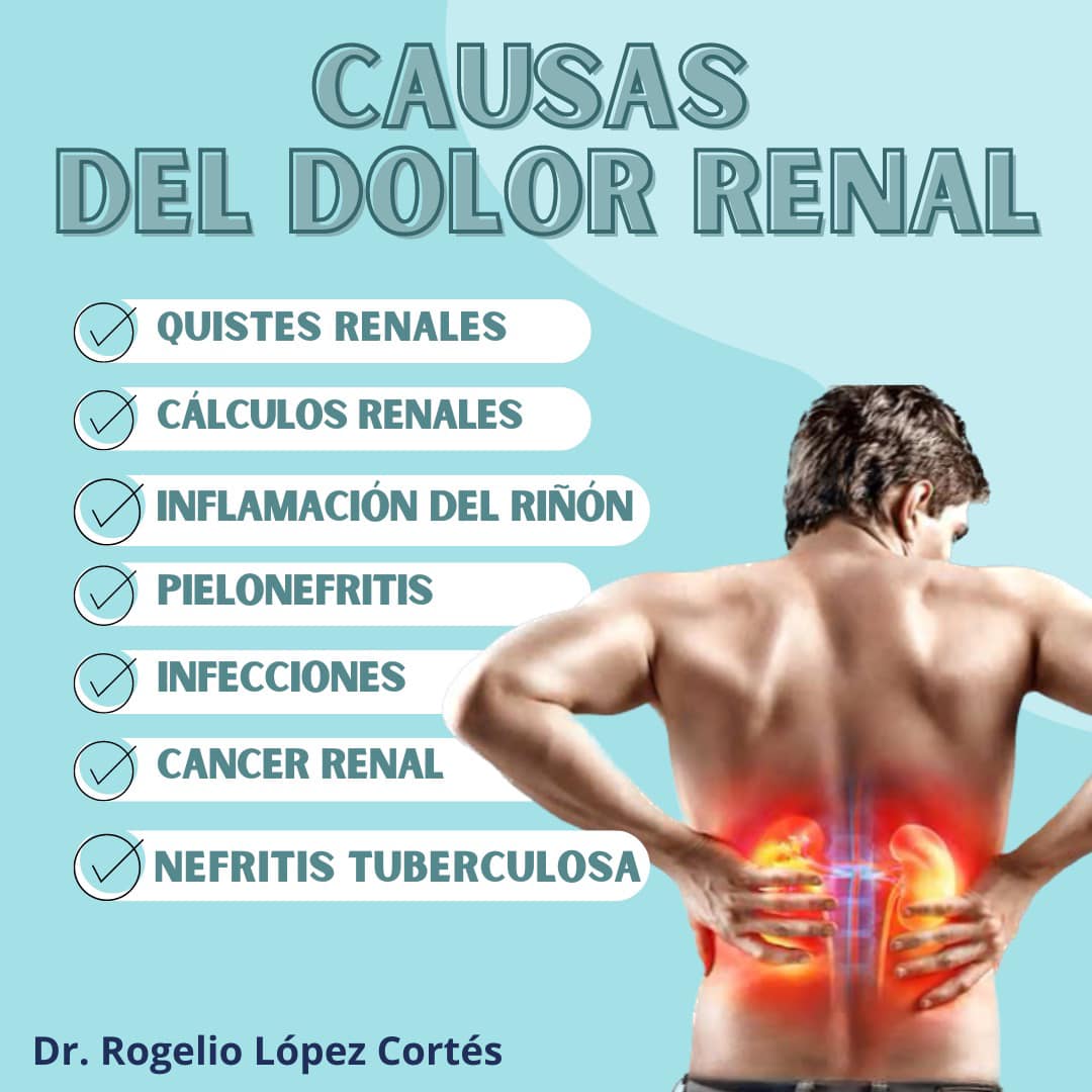El dolor en los riñones puede... - Dr. Rogelio López Cortés
