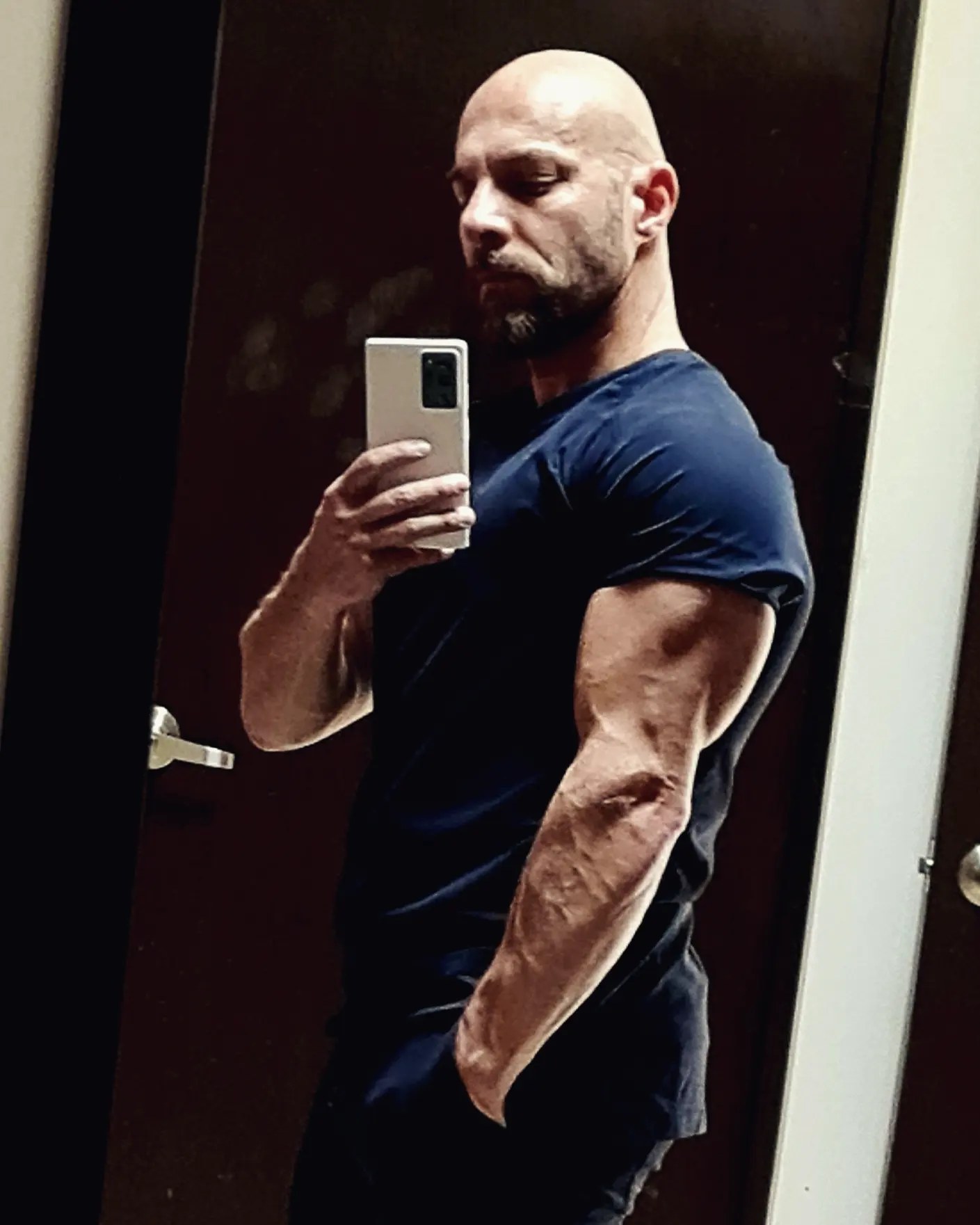 Cirugía Plástica, Estética y Reconstructiva. Dr. Mario H Mucharraz Díaz ...
