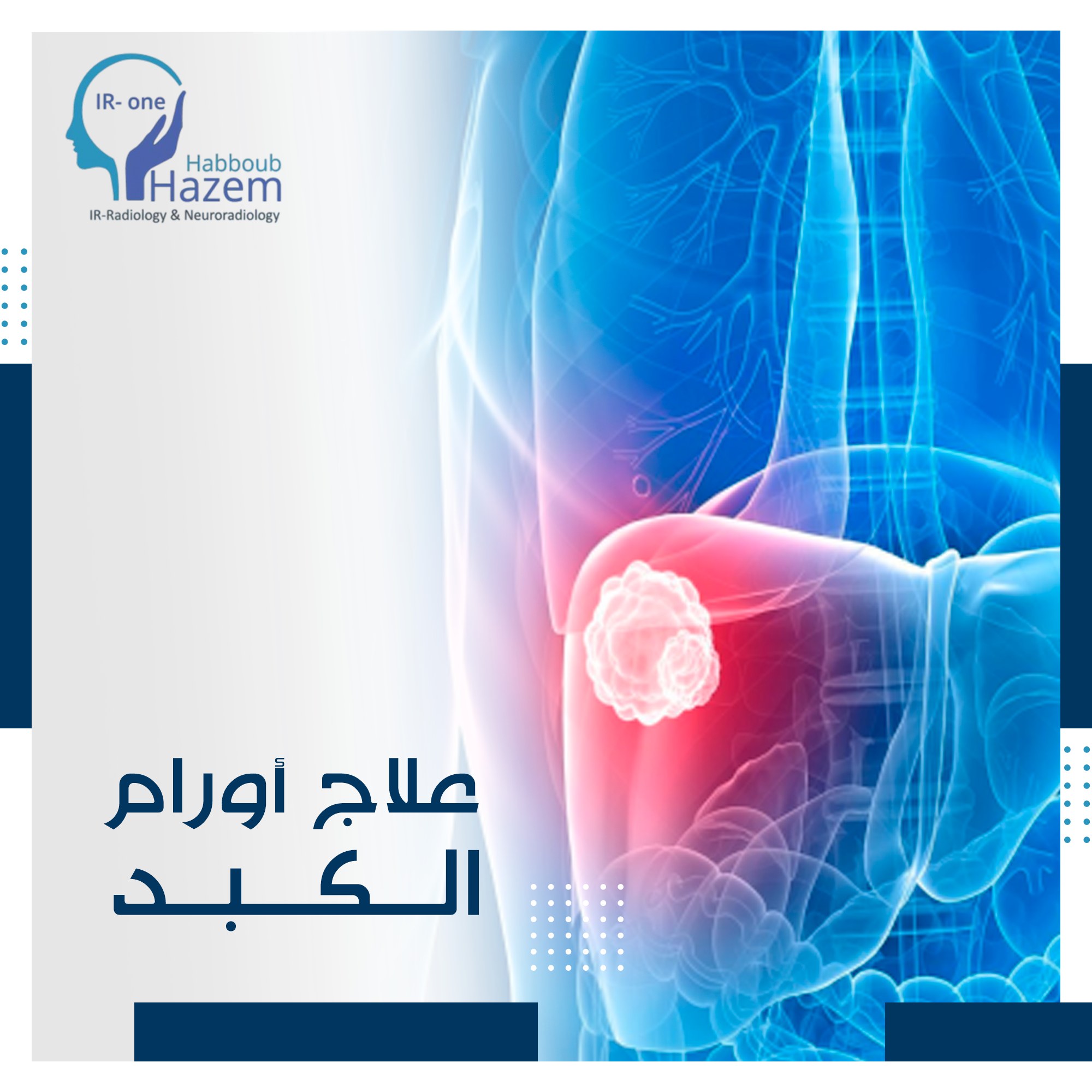 Dr.Hazem Habboub الدكتور حازم حبوب - من الأمراض الدماغية التي يتم ...