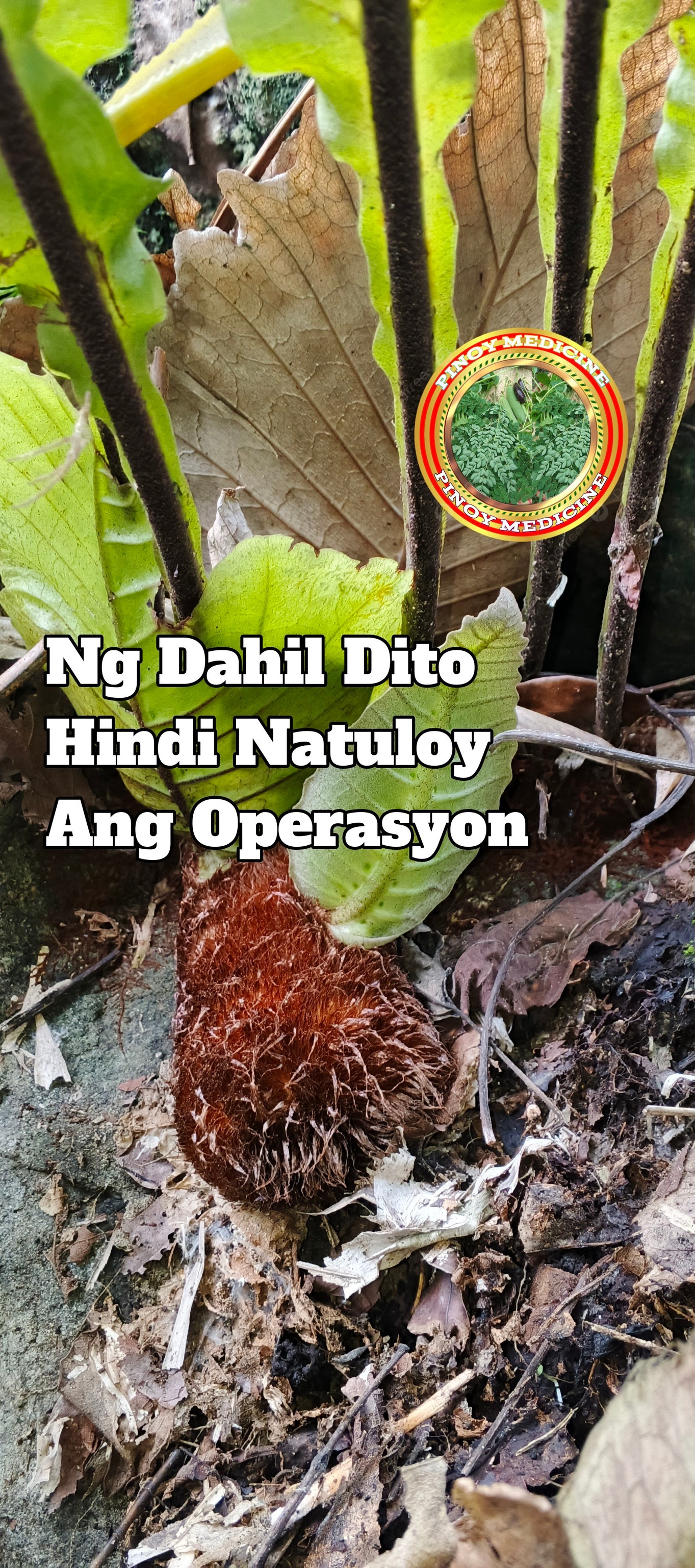 Pinoy - Sa may Bato sa kidney dyan at walang kakayahan na pang opera ...