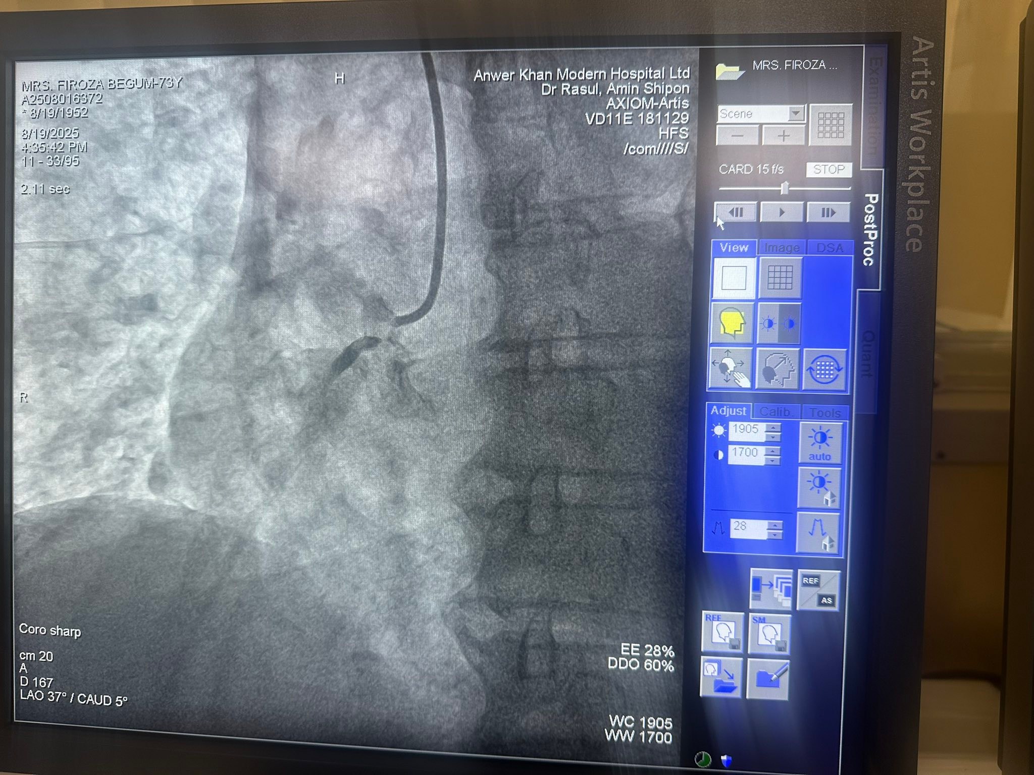 Dr. Md Rasul Amin Shepon, Interventional Cardiologist | Dhaka