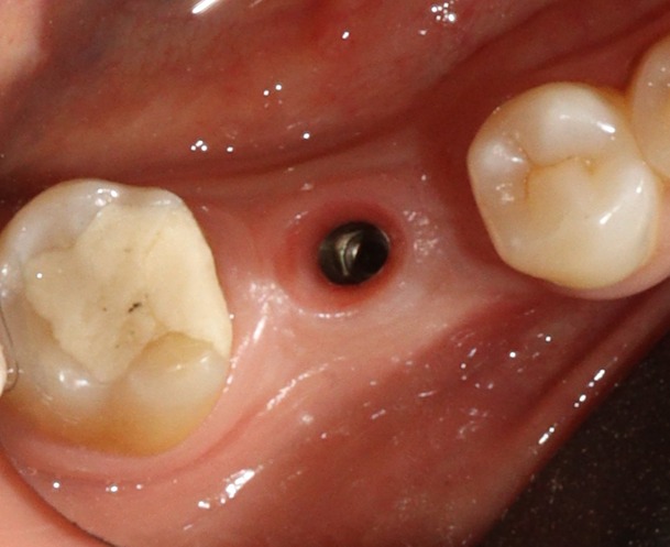 Dr. Arjun Hari Rijal, Periodontist and Oral Implantologist | Kathmandu