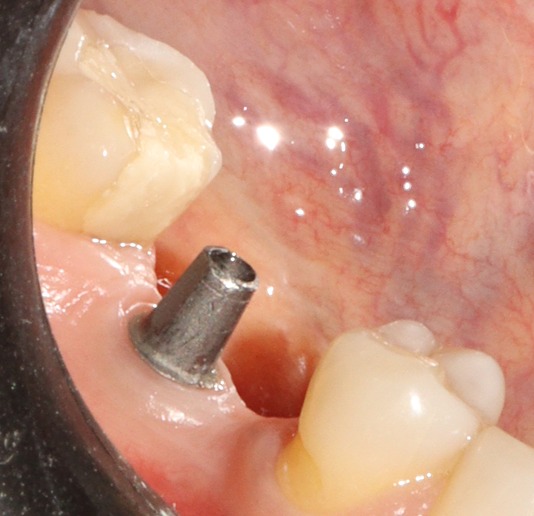 Dr. Arjun Hari Rijal, Periodontist and Oral Implantologist | Kathmandu