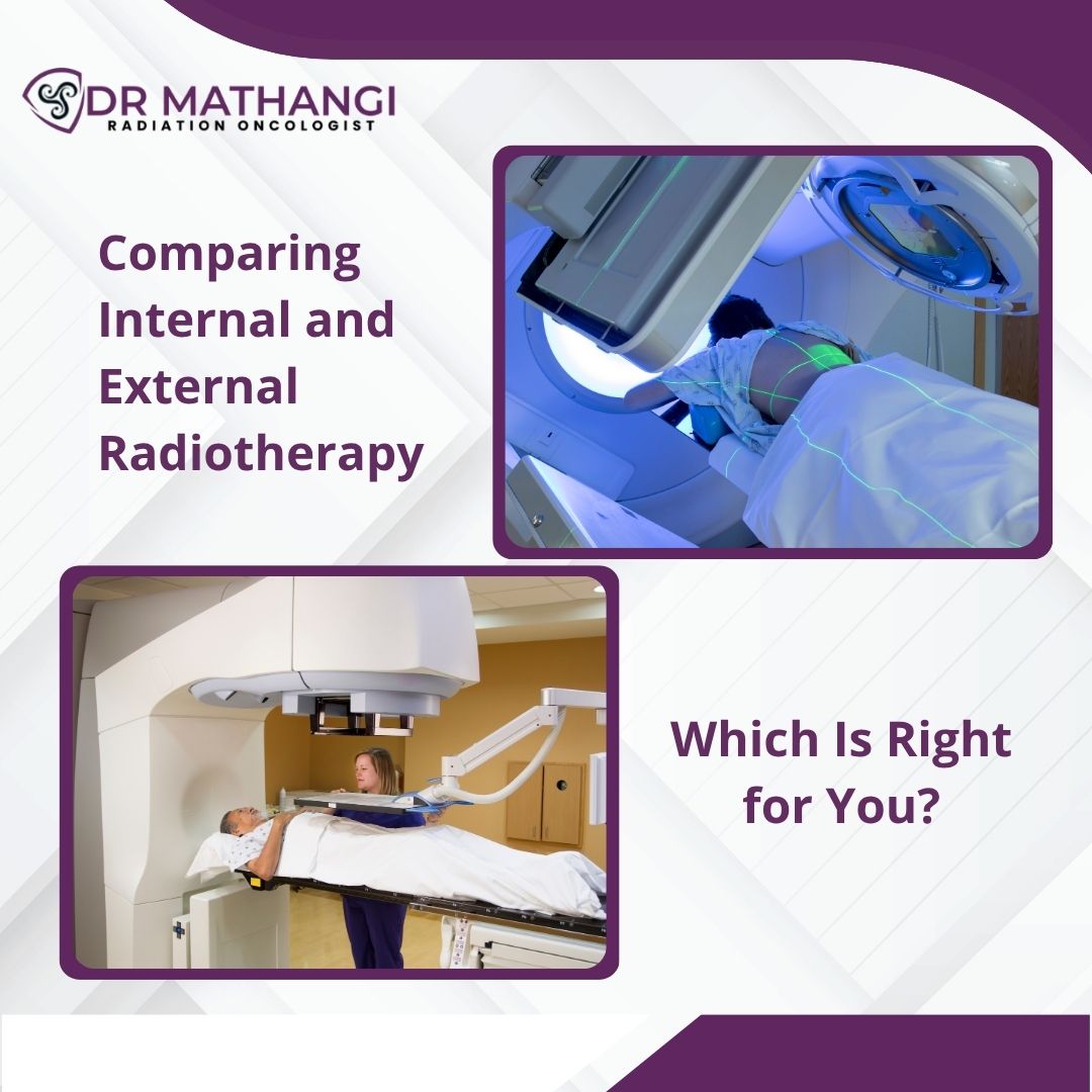 Dr Mathangi - Radiation oncologist - Bangalore | Bangalore