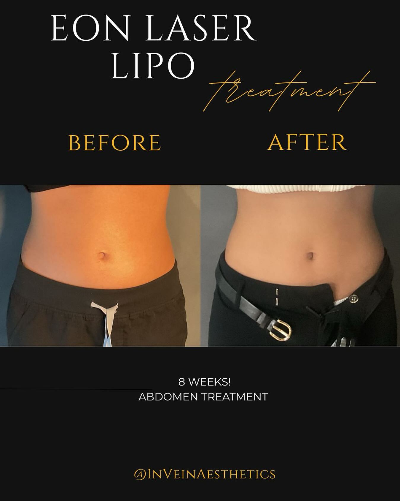 New at InVein — peptide therapy is here! 🏋️‍♀️ We're now offering: • Retatrutide - advanced weight management and appetite control • MOTS-c