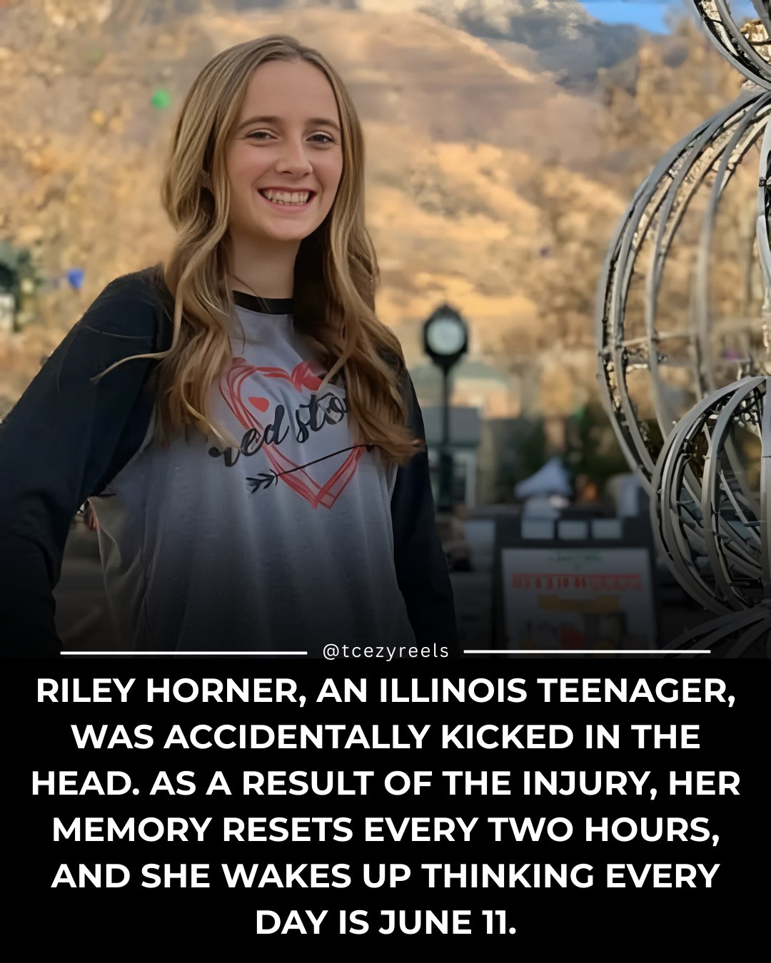 Tcezy - 🤕 After a head injury, teenager Riley developed a rare ...
