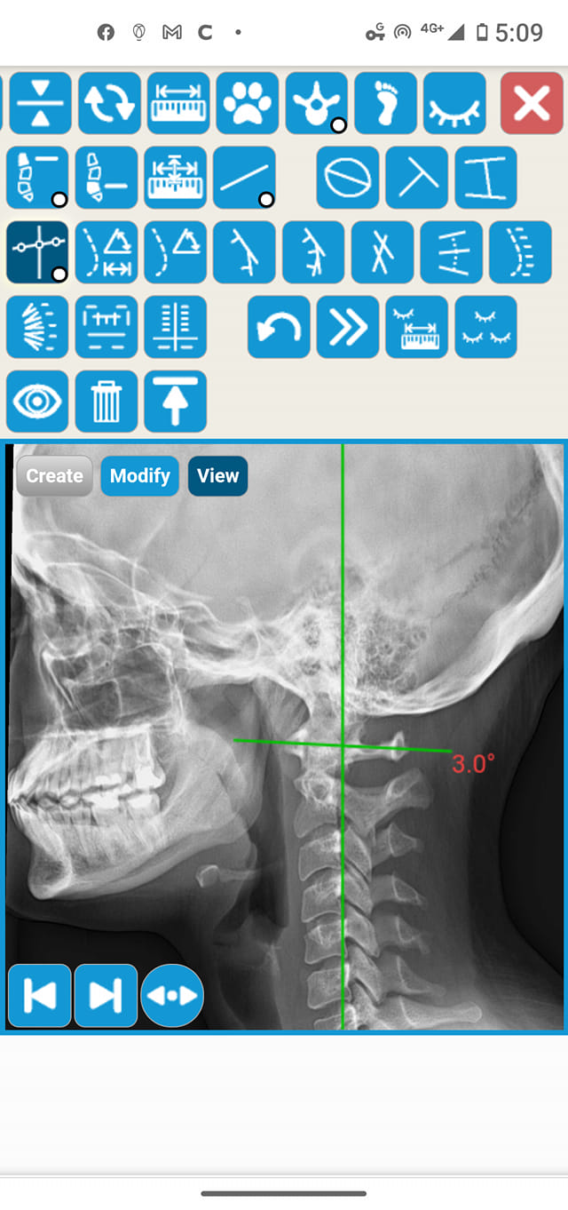 All of your X-ray Analysis... - Chiropractic X-ray Software