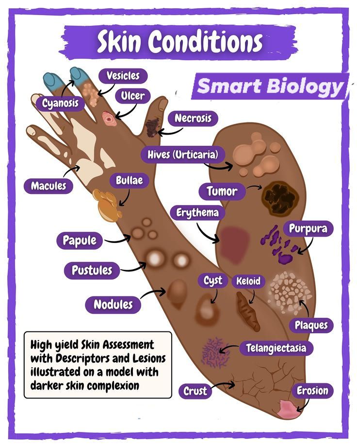 Smart - Skin Conditions | Facebook