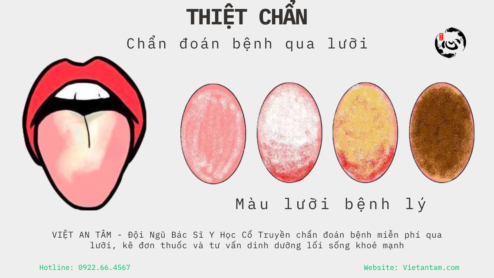 Tài liệu Y Khoa - Foramen cecum: lỗ tịt Crista galli: mảnh sàng ...
