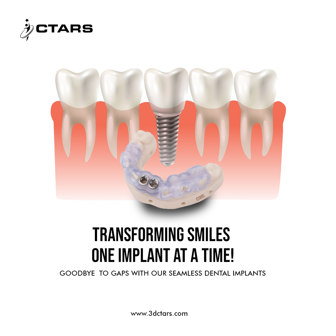 CTARS 3D | Chennai