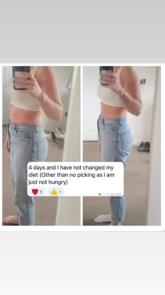 can you take l carnitine on non workout days If want more energy and get the best results from your workouts? Let's talk about L-Carnitine AKA Lemon Sherbet Fat Burners 🚀 Here's why it's a must in my fitness routine Left Side Abdominal Pain da Size:200 ml (2 x 100ml)