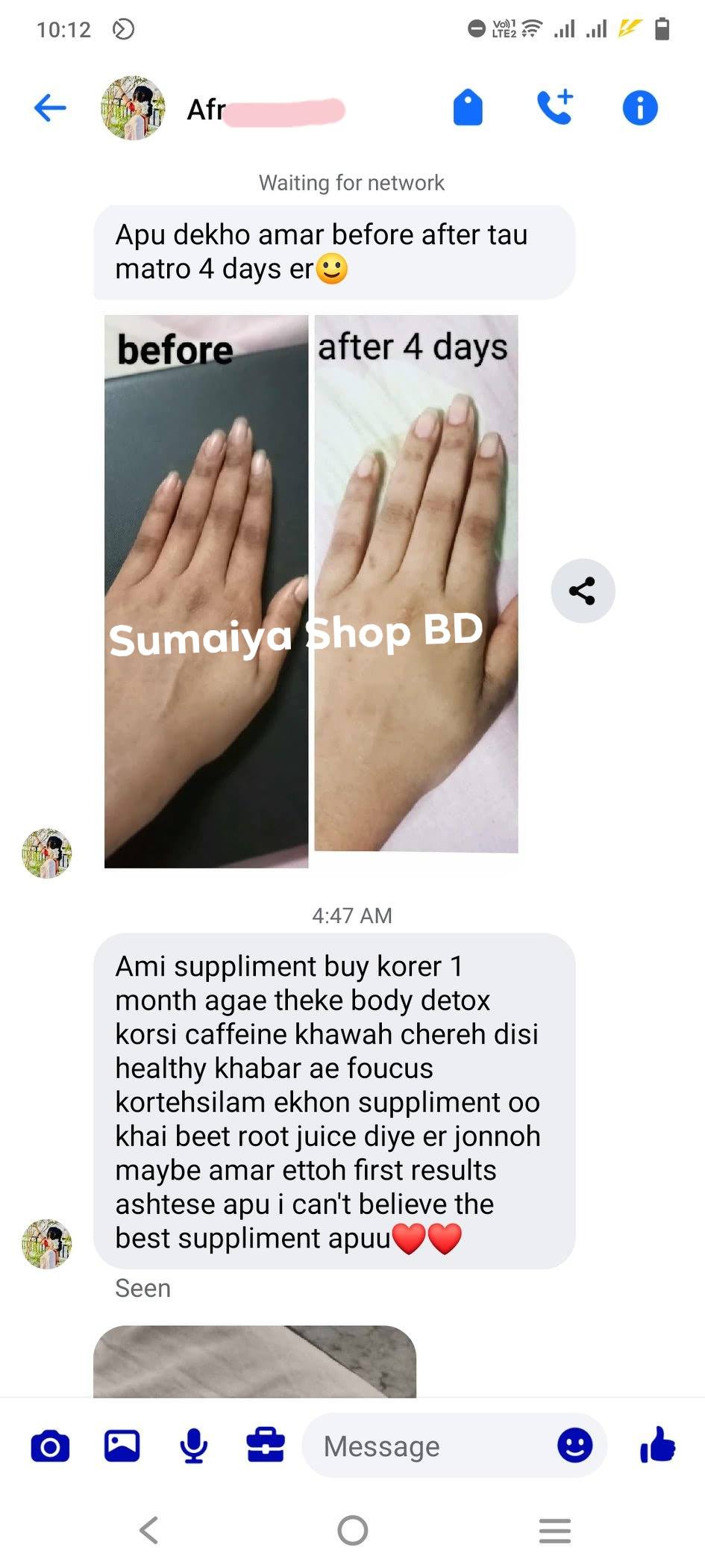 d blink glutathione supplement ৪ দিনে কাজ করা শুরু করছে 😳 মাশাআল্লাহ আলহামদুলিল্লাহ 🥹❤️ Subtype:Blackheads & Whiteheads Avon - Product Detail Size and Gauge:28 Gauge, 0.5 cc, 1/2
