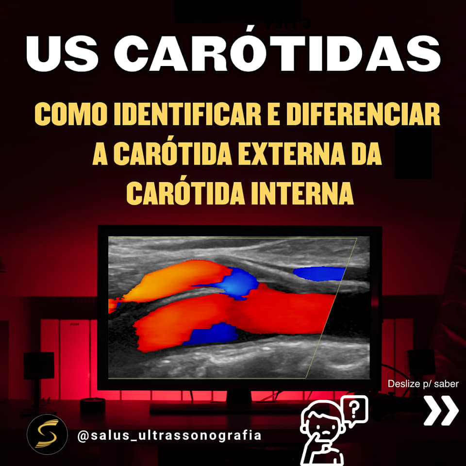 ⚜️DICAS DE COMO DIFERENCIAR A... - Salus ultrassonografia