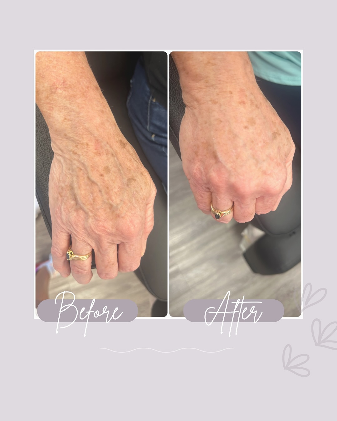 LOOK AT THIS. Reverse... - Core Beauty Med Spa and Wellness | Facebook