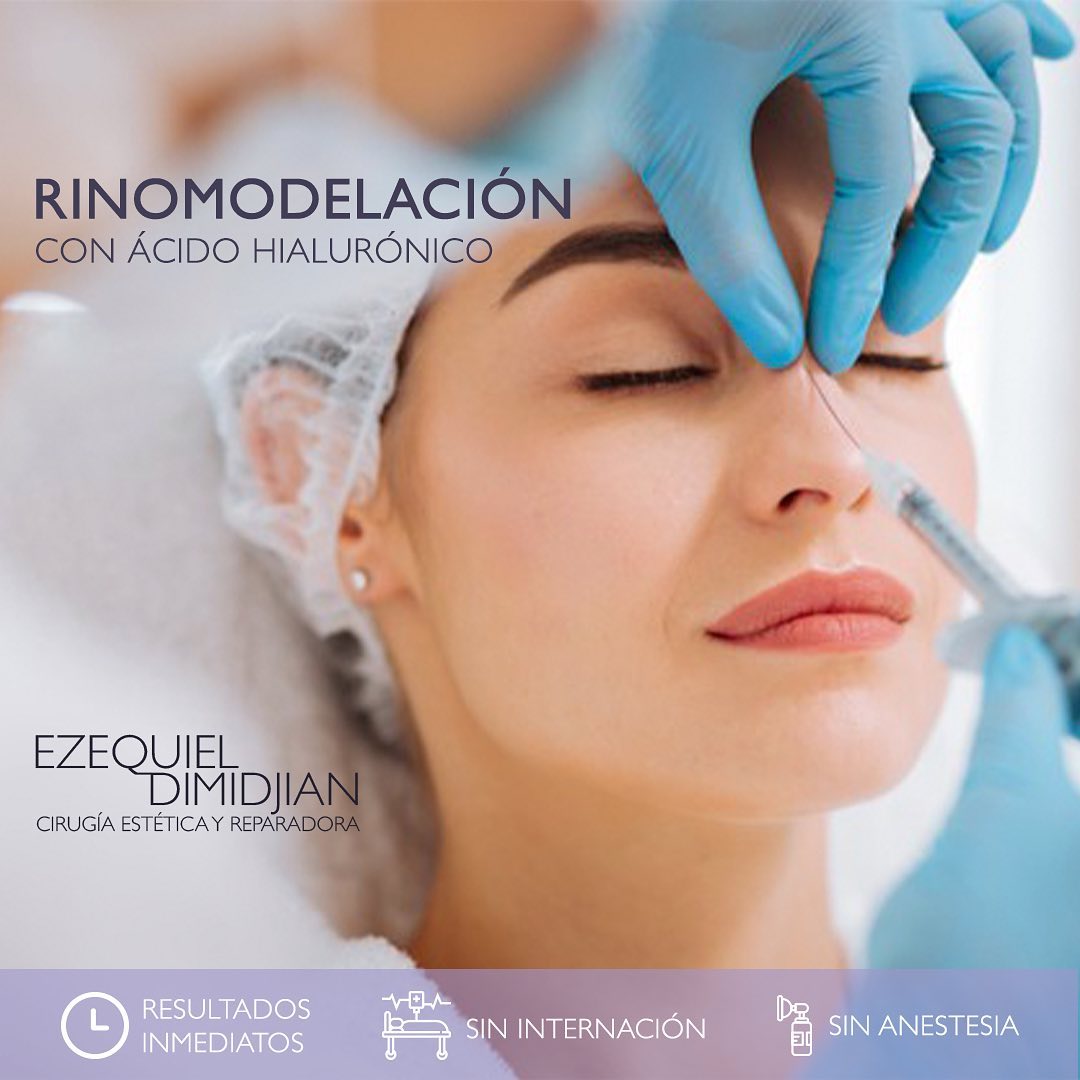 Dr Dimidjian - La rinomodelación con ácido hialurónico es...