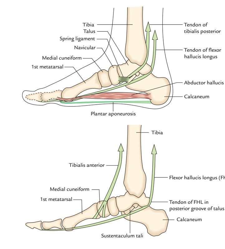 Knowledge3dart - 🦶 MEDIAL LONGITUDINAL ARCH SUPPORT –... | Facebook