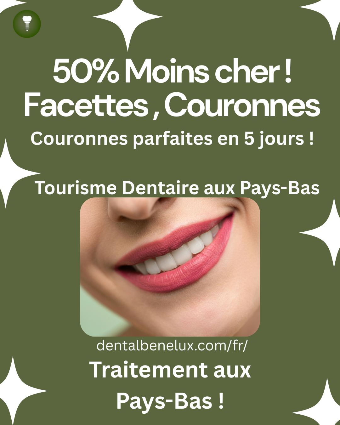 Slap Fast® - Outil D'Entraînement Tennis Pour Améliorer Instantanément Ta Frappe