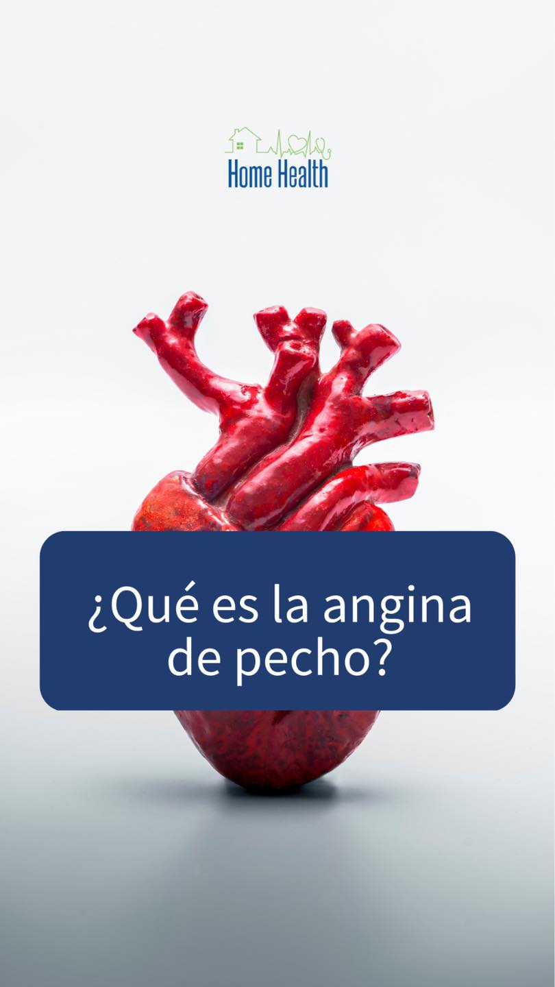 Te decimos qué es la angina de pecho - Home Health Medical