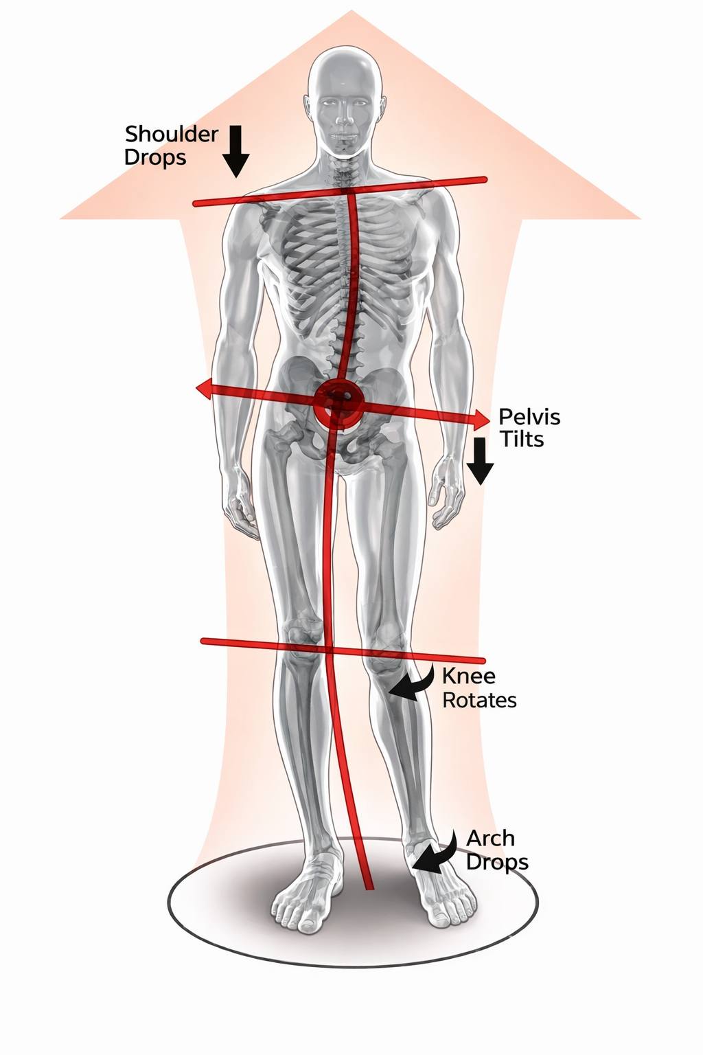 Knowledge3dart - Pathobiomechanics of Global Postural Asymmetry ...
