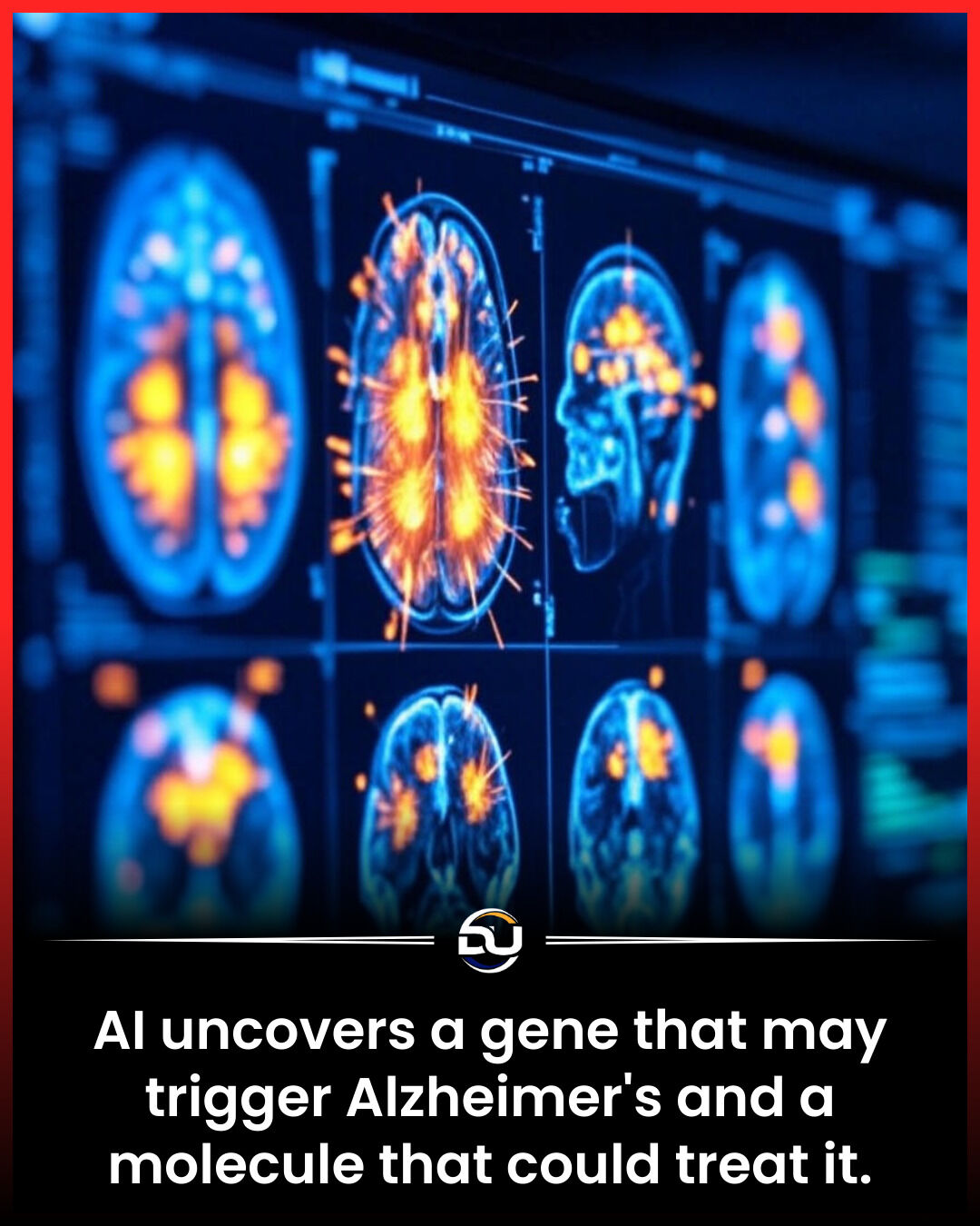 Discover - A Gene and Molecule Could Unlock Alzheimer’s Treatment In a ...