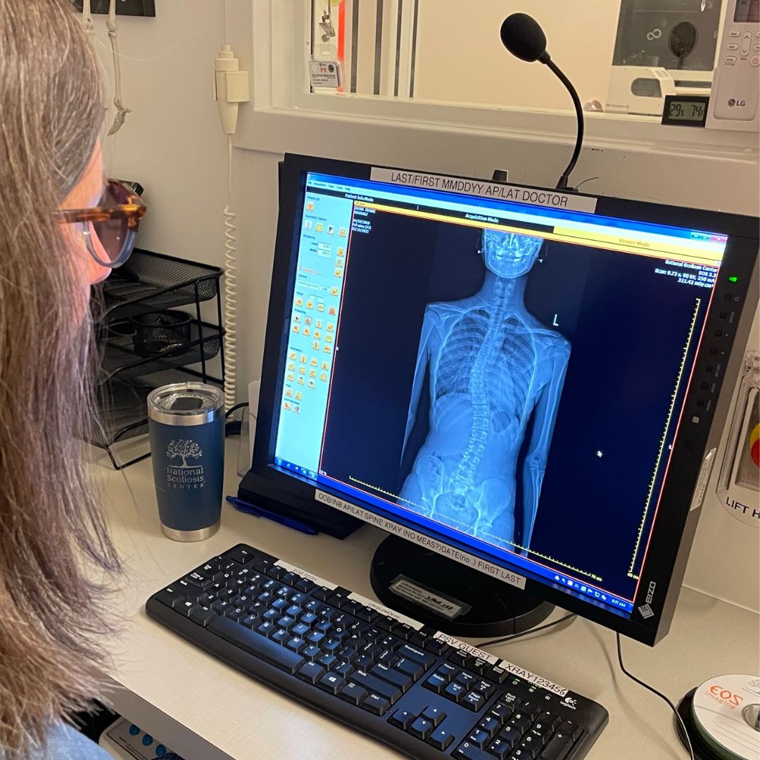 🔍 Wisdom Wednesday: Unveiling... - National Scoliosis Center
