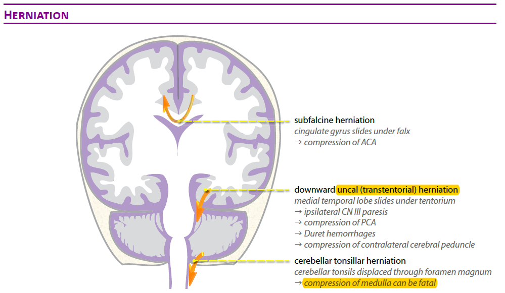 Types of cerebral herniations ..... - Radiology Archive