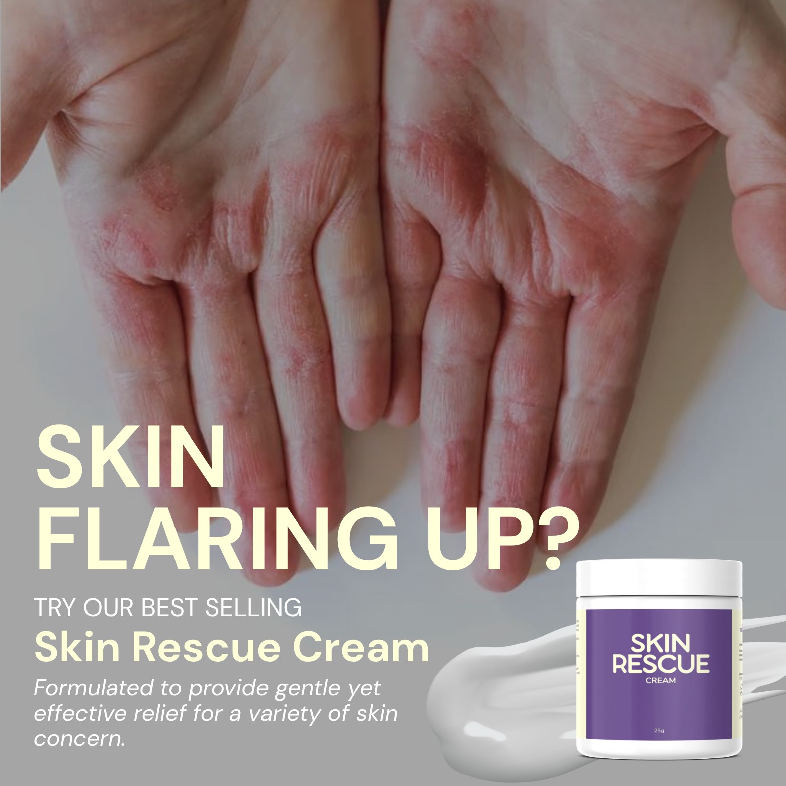 Skin Rescue - 🔥 Struggling with Eczema, Psoriasis, or Skin... | Facebook