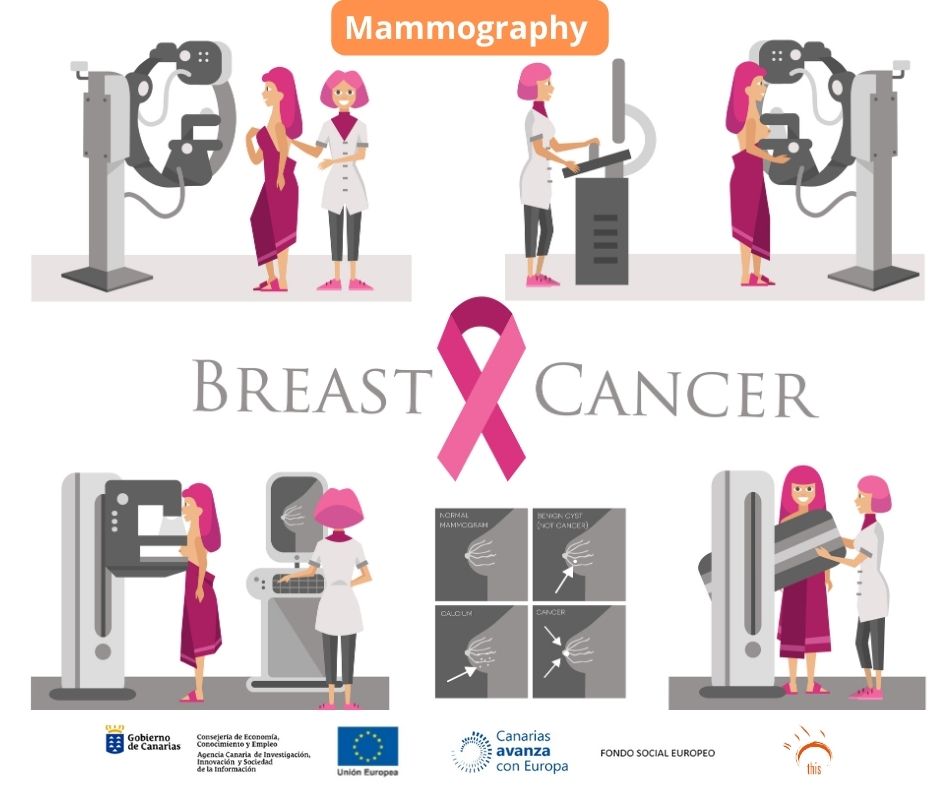 Thismedical - What is a mammography examination, and how can it help ...