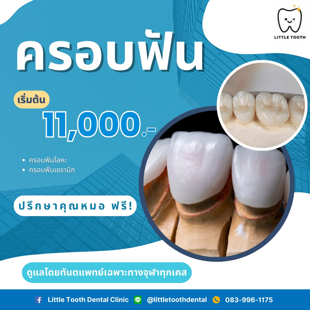 Little - ฟันแตก ฟันผุ ฟันรักษาราก มาทางนี้😎 ทำครอบฟันโลหะหรือเซรามิกกับ ...