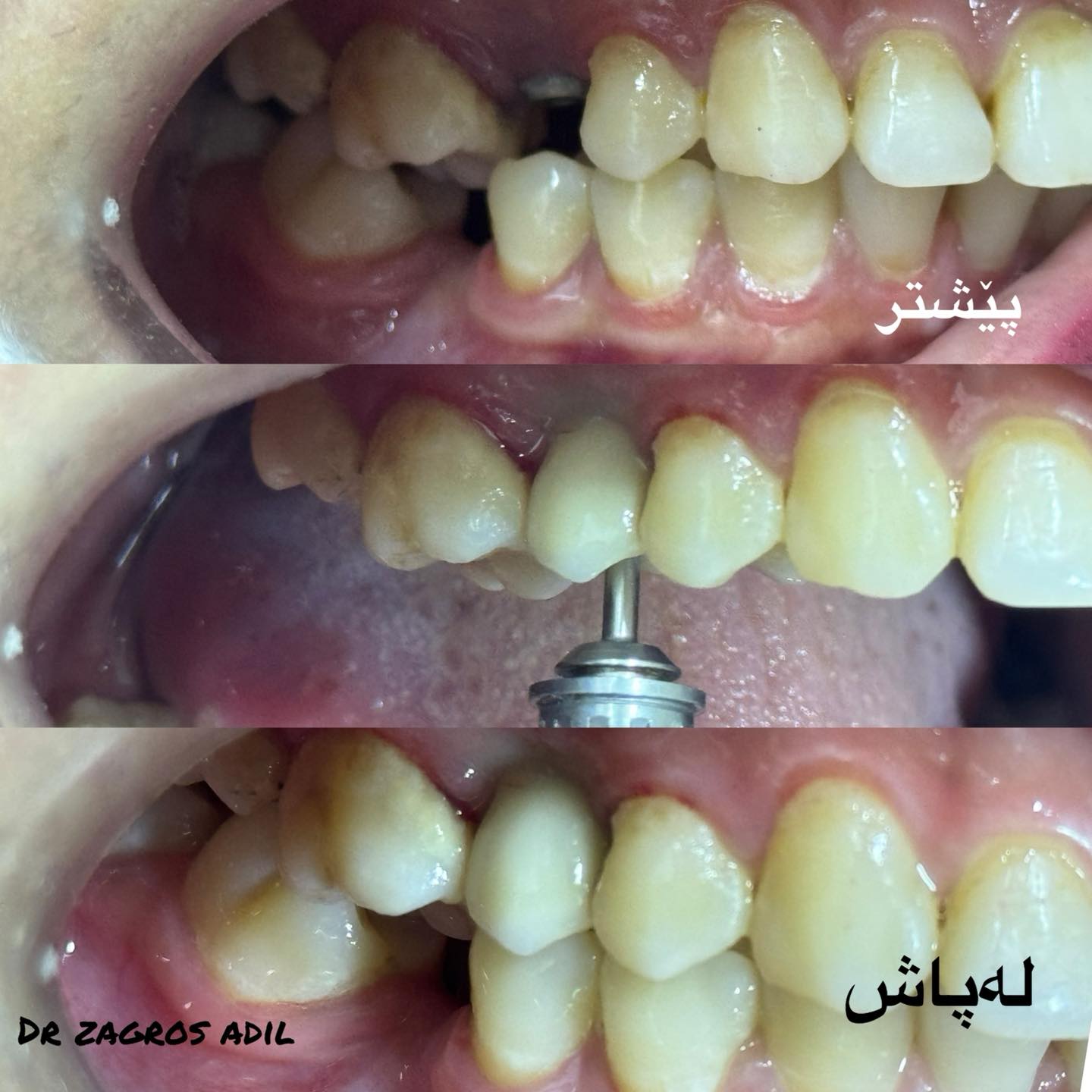 پزيشكي ددان/د.زاگروس عادل ياور Dr. Zagros Adil Yawer | Kalar