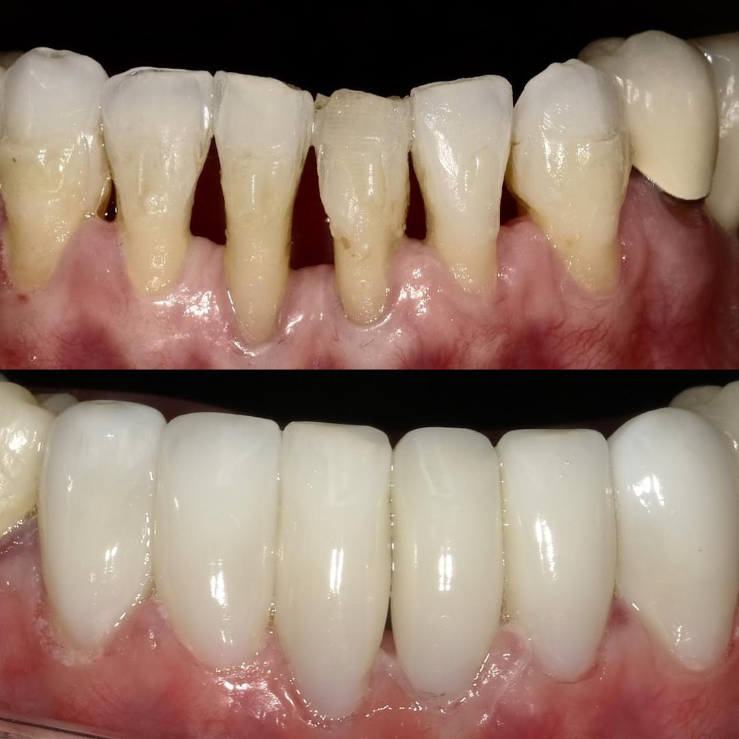 Check out this amazing before and... - Bioclear Matrix System | Facebook