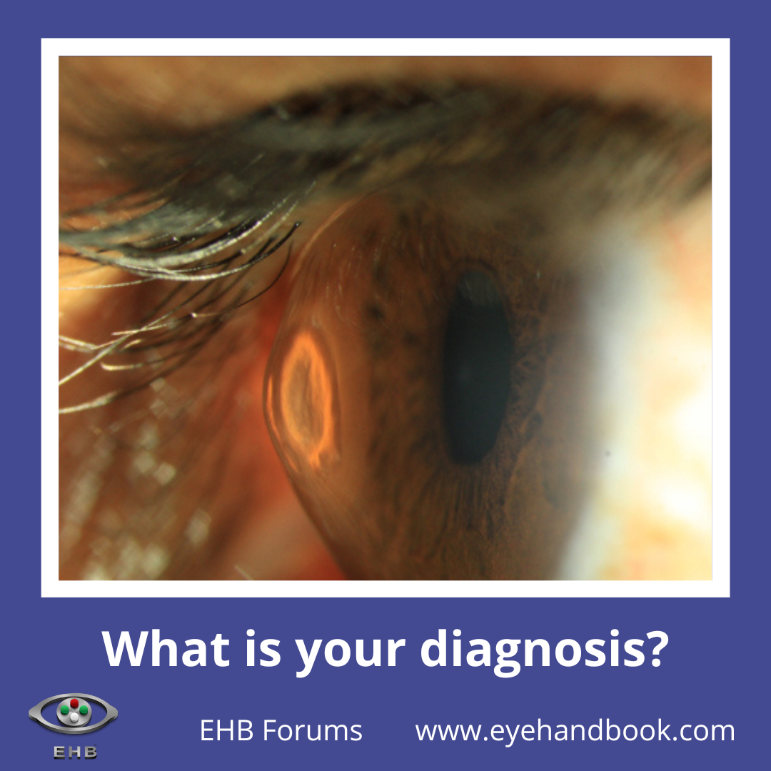 Eye Handbook - What is your diagnosis? You can access eye atlas, eye ...