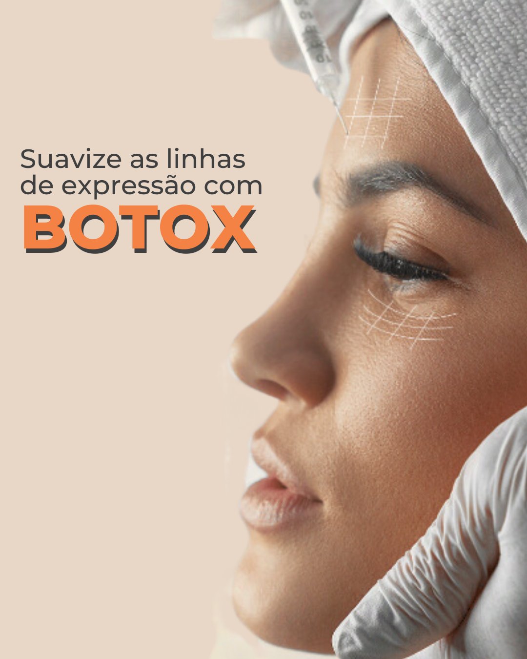 Clínica VilaBen - O Botox é um procedimento estético...