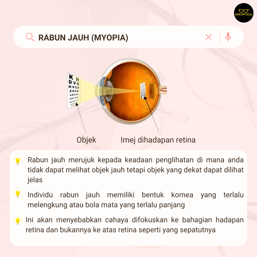 SMS Optical - JOM KENALI JENIS-JENIS RABUN 🤓 Korang ada...