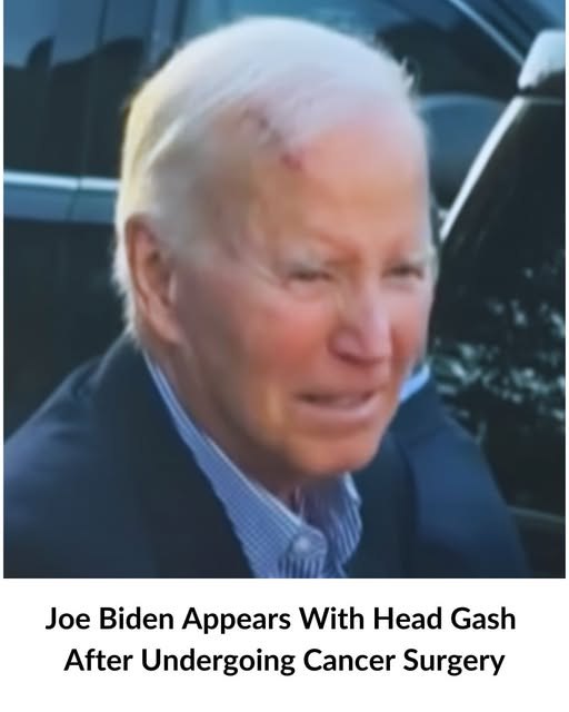 Ifana - Joe Biden Appears With Head Injury After Undergoing Cancer ...