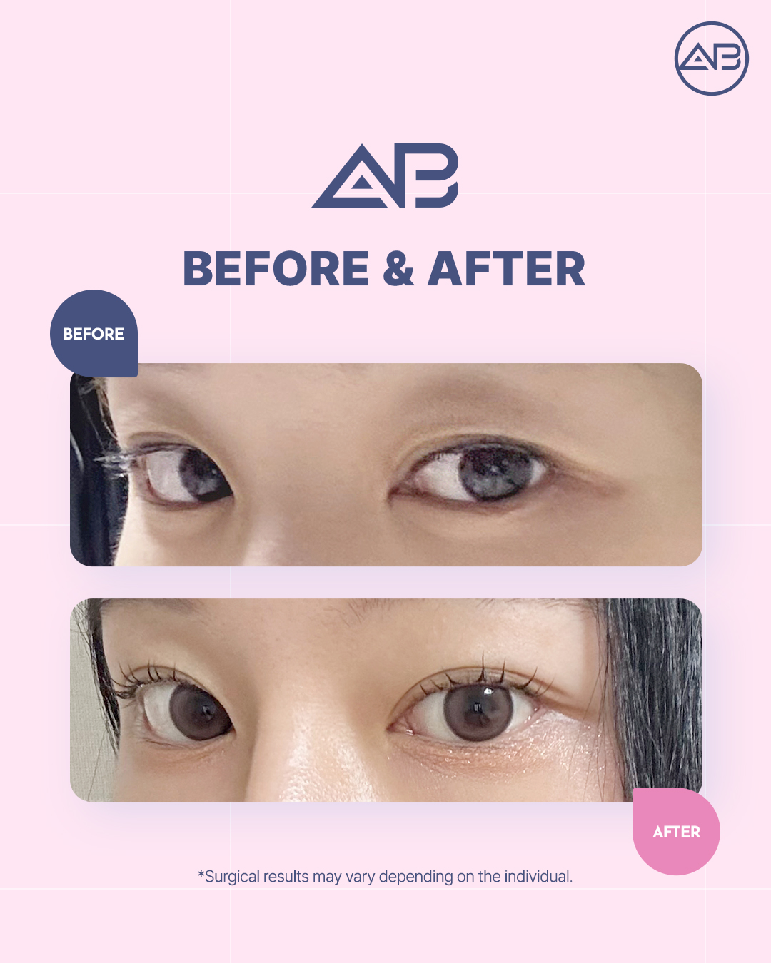 Brighter, wider, and more... - AB Plastic Surgery Hospital | Facebook