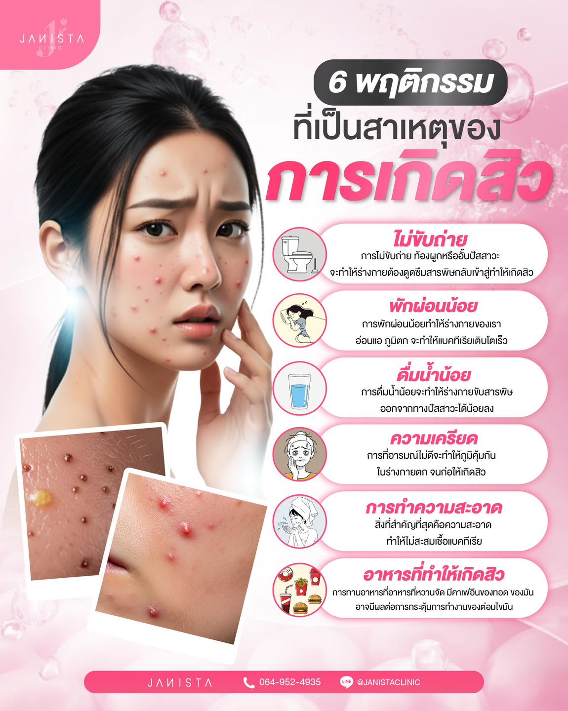 รู้ยัง 6... - Janista Clinic - สาขาเชียงใหม่ | Facebook