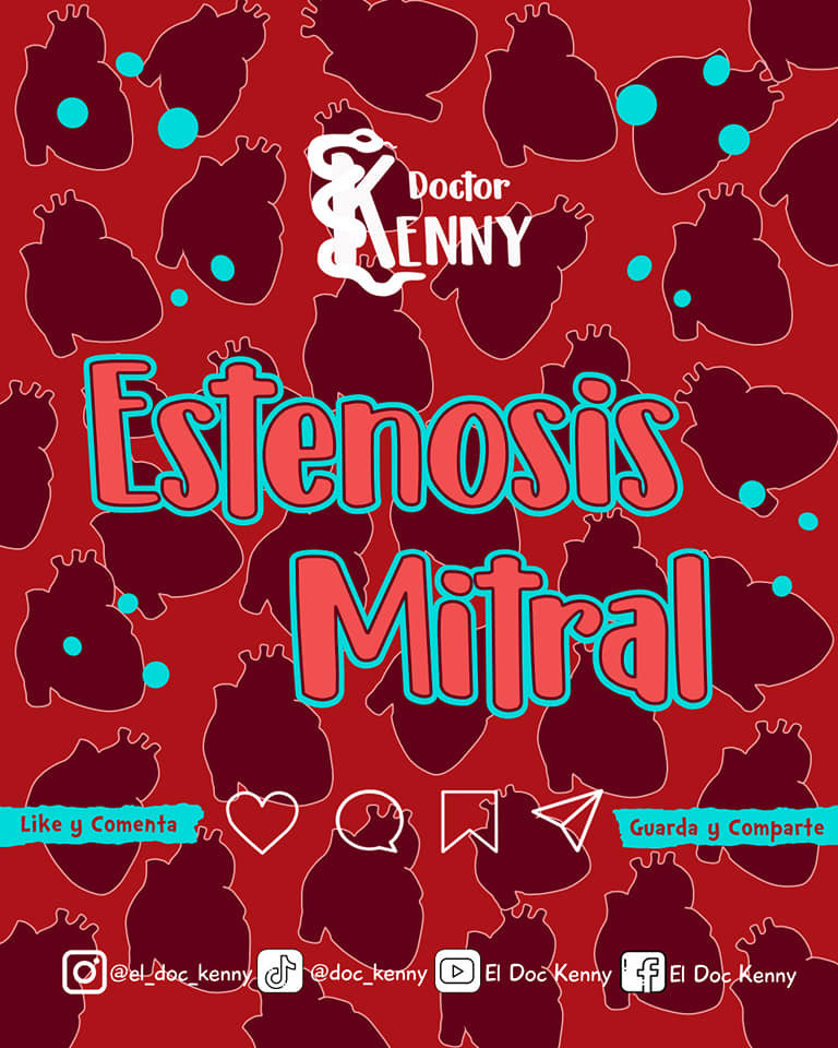 El Doc Kenny - NUEVO POST CARDIOLOGÍA Estenosis Mitral🫀🤓...