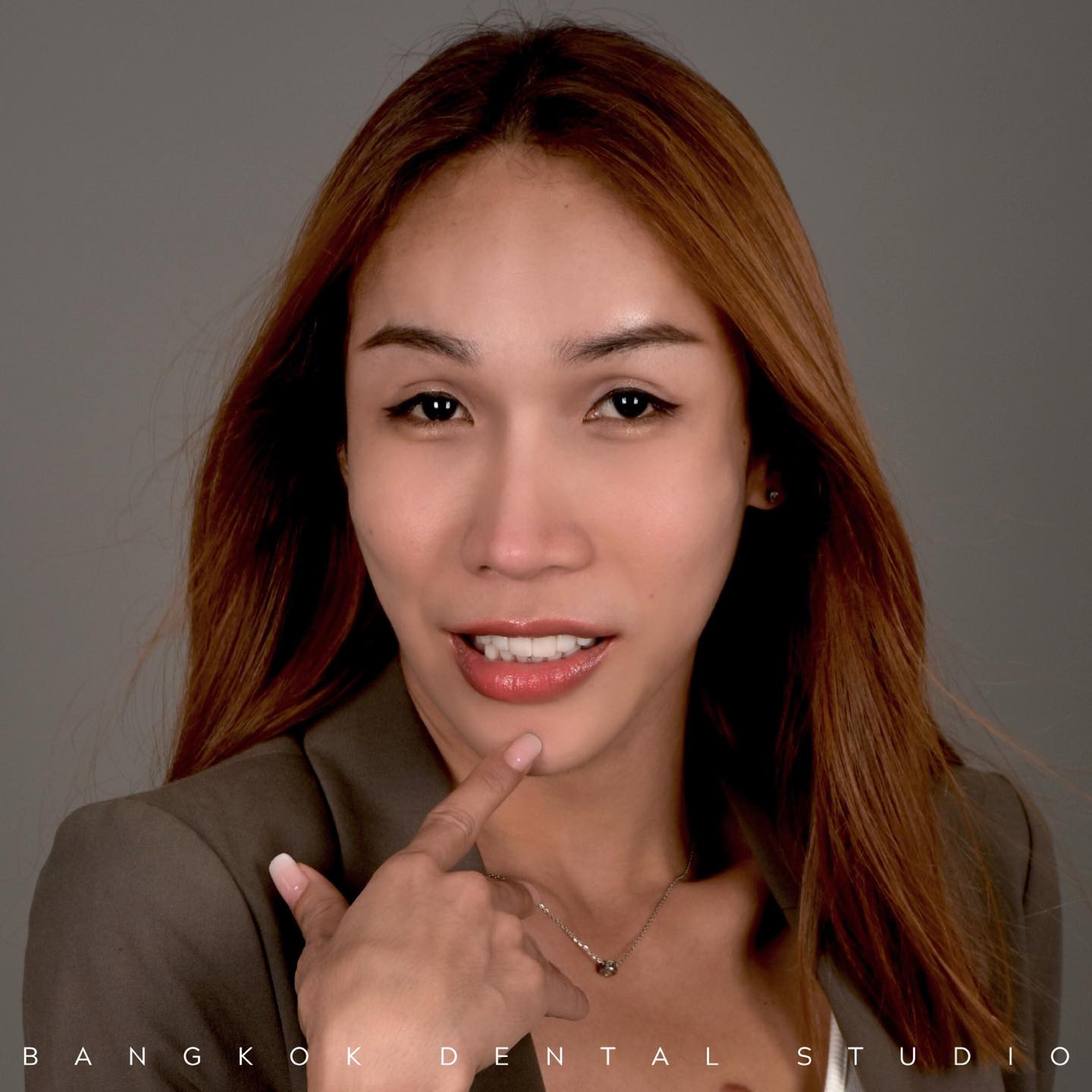 ฟันขาวสวย แบบไม่อวย 😁 ขอขอบคุณคุณแนท @pp_ranut ที่เลือกมาทำฟันกับคุณหมอ ...
