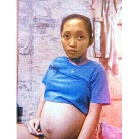 Berna Espina Home Facebook She also broke her arm as well from the. facebook