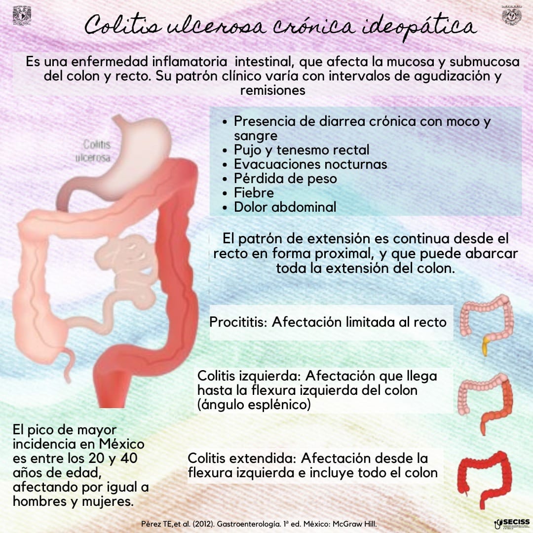 La colitis ulcerosa crónica idiopática (CUCI) es una enfermedad ...