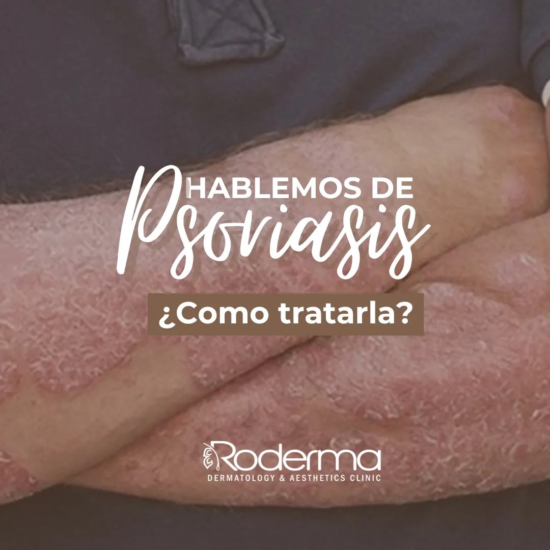 Roderma - Centro de Dermatología y Medicina Estética