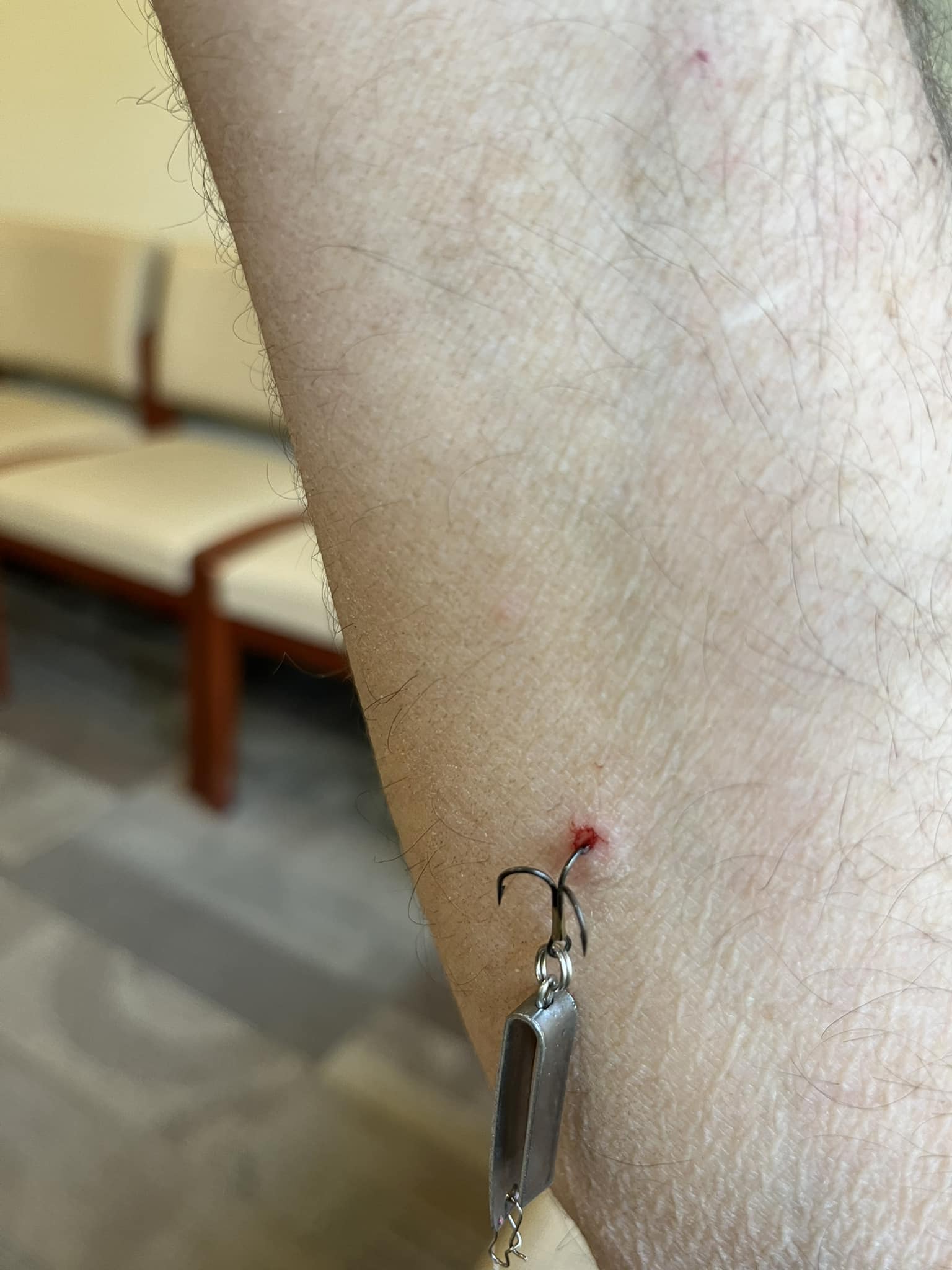 adirondack hospital fishing lures Lake X Dr. Evil – Team Rhino Outdoors LLC the BigMakk consistently draws explosive strikes from fish looking to ambush prey on the surface Painfully hooked: Adirondack hospital fishing